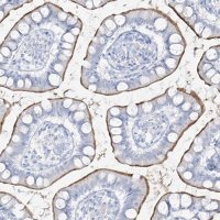 Anti-SLC26A3 antibody produced in rabbit