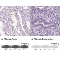 Anti-SLC26A8 antibody produced in rabbit 