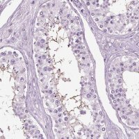Anti-SLC26A8 antibody produced in rabbit 