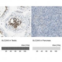 Anti-SLC2A5 antibody produced in rabbit