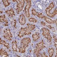 Anti-SLC2A6 antibody produced in rabbit 