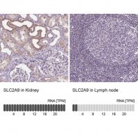 Anti-SLC2A9 antibody produced in rabbit 