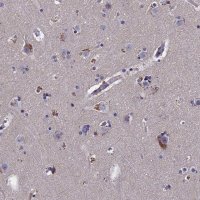 Anti-SLC33A1 antibody produced in rabbit