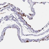 Anti-SLC34A2 antibody produced in rabbit