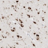 Anti-SLC35F6 antibody produced in rabbit
