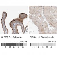 Anti-SLC38A10 antibody produced in rabbit 