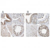 Anti-SLC38A10 antibody produced in rabbit 
