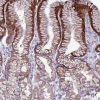 Anti-SLC44A3 antibody produced in rabbit