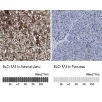 Anti-SLC47A1 antibody produced in rabbit