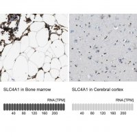 Anti-SLC4A1 antibody produced in rabbit 