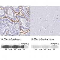 Anti-SLC5A1 antibody produced in rabbit 