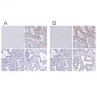 Anti-SLC5A1 antibody produced in rabbit 