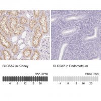 Anti-SLC5A2 antibody produced in rabbit 