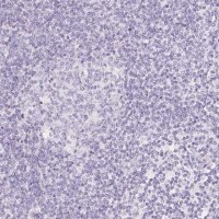 Anti-SLC5A2 antibody produced in rabbit 