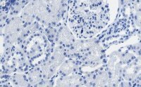 Anti-SLC5A2 Antibody, clone 2I4 ZooMAb® Rabbit Monoclonal