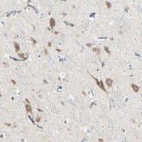 Anti-SLC6A15 antibody produced in rabbit 