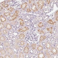 Anti-SLC6A18 antibody produced in rabbit 