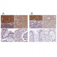 Anti-SLC8A2 antibody produced in rabbit