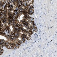 Anti-SLCO2A1 antibody produced in rabbit 