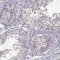 Anti-SLCO6A1 antibody produced in rabbit