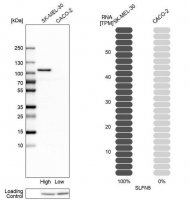 Anti-SLFN5 antibody produced in rabbit