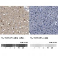 Anti-SLITRK1 antibody produced in rabbit 