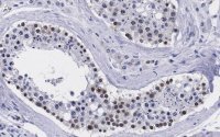 Anti-Smad1 Antibody, clone 1B9 ZooMAb� Rabbit Monoclonal 