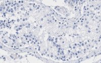 Anti-Smad1 Antibody, clone 1B9 ZooMAb� Rabbit Monoclonal 