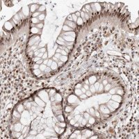 Anti-SMAD7 antibody produced in rabbit