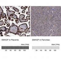 Anti-SMAGP antibody produced in rabbit 
