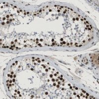 Anti-SMARCAD1 antibody produced in rabbit 