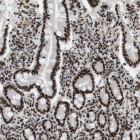 Anti-SMARCB1 antibody produced in rabbit 