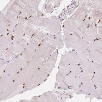 Anti-SMARCD3 antibody produced in rabbit