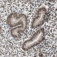 Anti-SMARCE1 antibody produced in rabbit