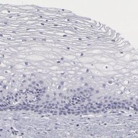 Anti-SMC1B antibody produced in rabbit