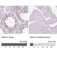 Anti-SMC5 antibody produced in rabbit 