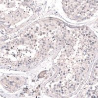 Anti-SMC6 antibody produced in rabbit