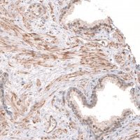 Anti-SMC6 antibody produced in rabbit