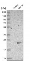 Anti-SMCP antibody produced in rabbit HPA035105-100UL