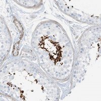 Anti-SMCP antibody produced in rabbit HPA035105-100UL