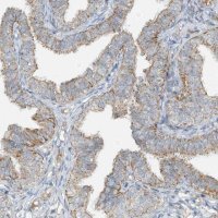 Anti-SMDT1 antibody produced in rabbit