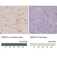 Anti-SMIM13 antibody produced in rabbit 