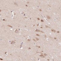 Anti-SMIM13 antibody produced in rabbit 