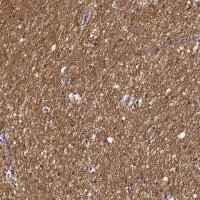 Anti-SMIM17 antibody produced in rabbit 