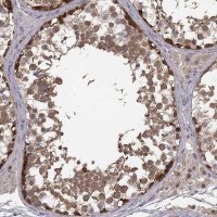 Anti-SMURF2 antibody produced in rabbit