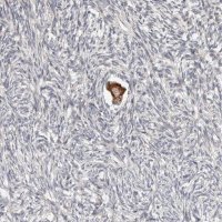 Anti-SMYD4 antibody produced in rabbit 
