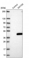 Anti-SMYD5 antibody produced in rabbit HPA049002-100UL
