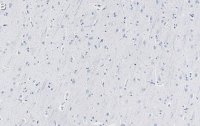 Anti-SNAP-25 Antibody, clone 1J9 ZooMAb� Rabbit Monoclonal 