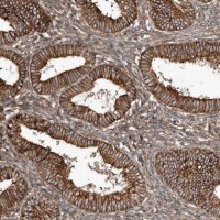 Anti-SNAP47 antibody produced in rabbit