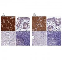 Anti-SNAP91 antibody produced in rabbit 